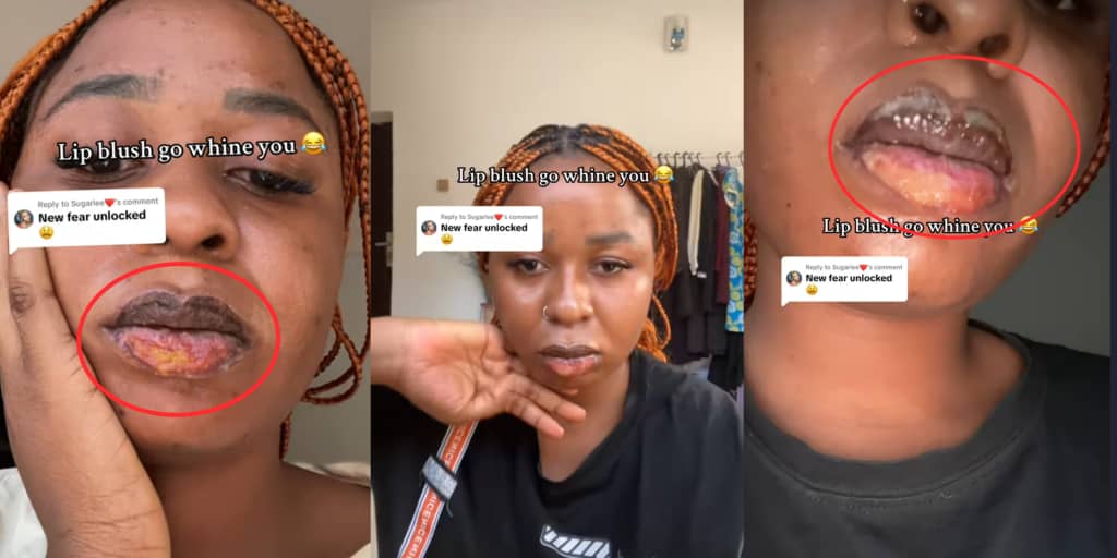 Lady reveals damage from lip blush procedure