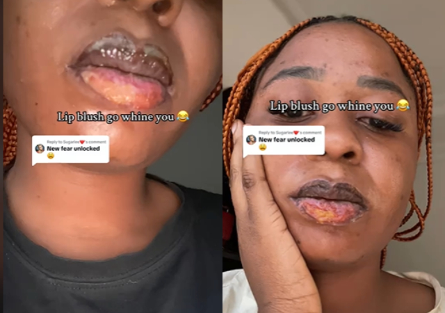 lady discloses damage from lip blush procedure